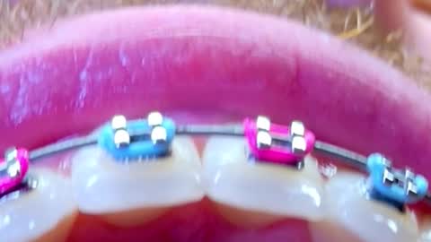 Snapshot of los_juanes chatting on 02-15-26, 10:28 JUAN JUAN online show from 02-15-26, 10:28